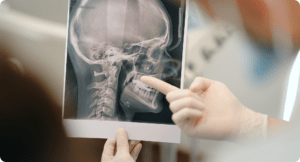 Dentist pointing to a patient's dental X-ray showing the teeth and jawbone while explaining the diagnosis and treatment options.
